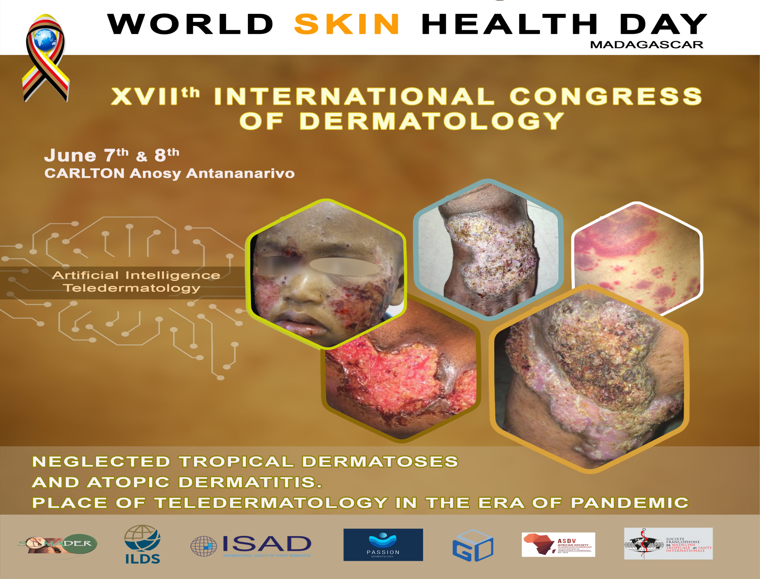 WSHD Mada 2022-04-02-2022 SLIDE 1